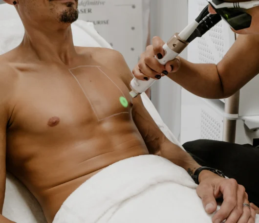 Épilation definitive au laser à Muret