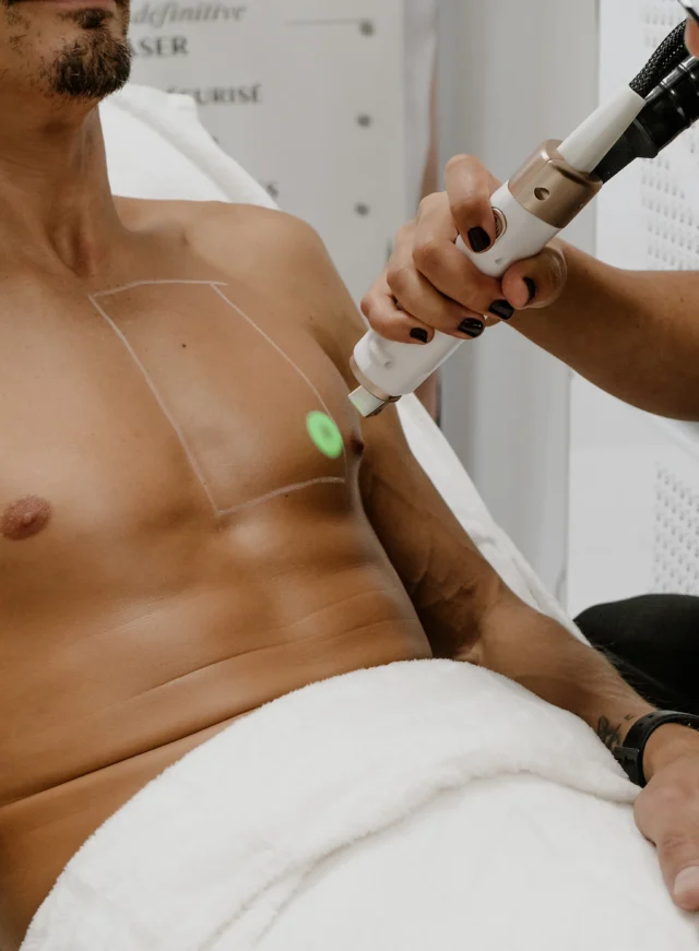 Épilation definitive au laser à Muret