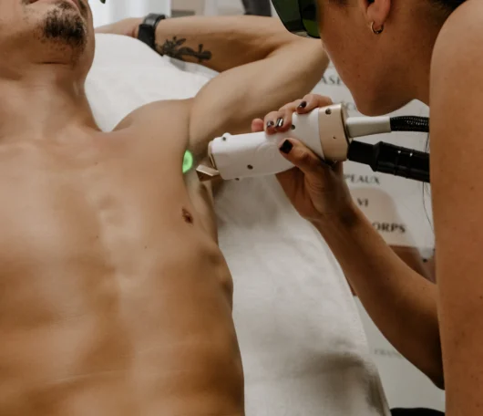 Épilation laser épilation définitive à Muret