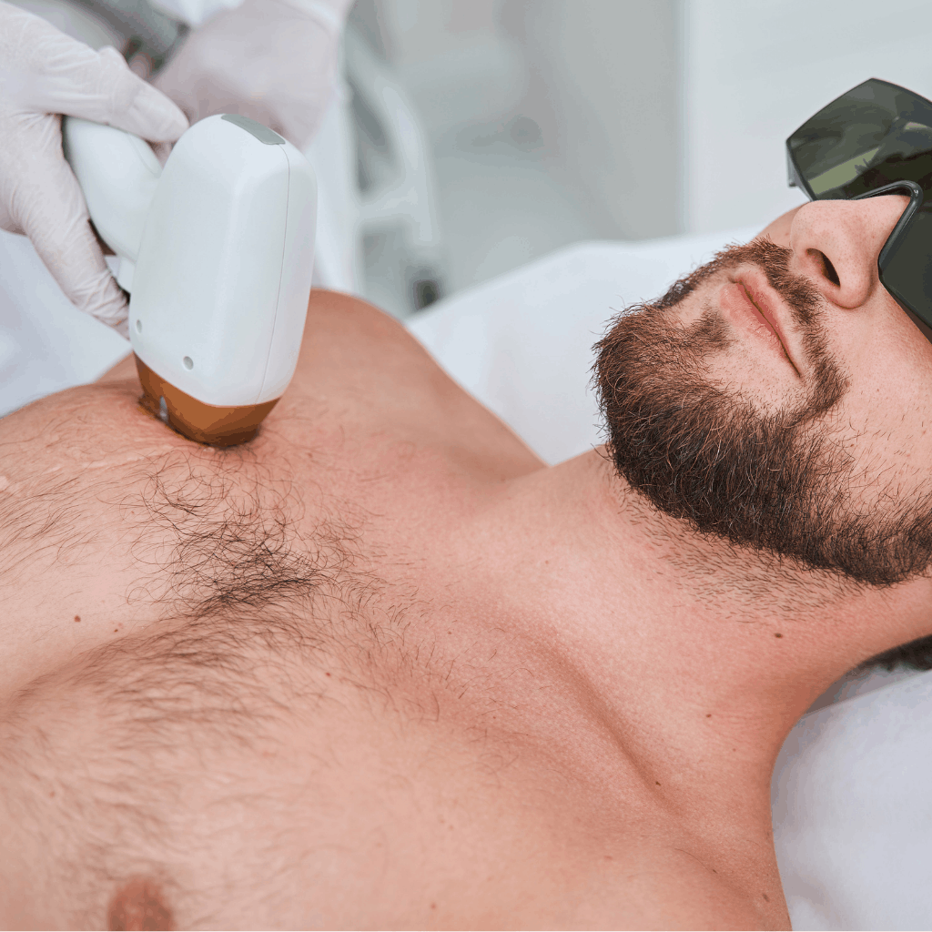 épilation laser du torse pour les hommes au centre Céor à Muret