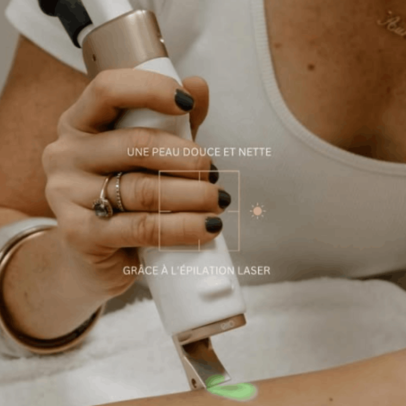 guide-sur-epilation-laser-ceor (1)
